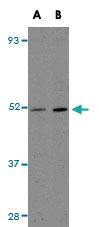 Anti-CCDC47 Rabbit Polyclonal Antibody