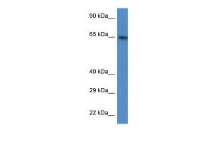 Anti-ACSS2 Rabbit Polyclonal Antibody