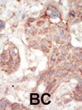 Anti-FLT3 Rabbit Polyclonal Antibody (Biotin)