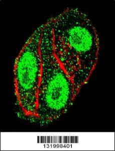 Anti-SFTPC Rabbit Polyclonal Antibody (FITC (Fluorescein Isothiocyanate))