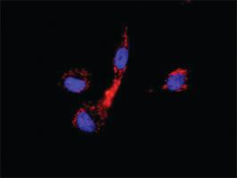 Anti-CCNB1 + CDKN1A Antibody Pair