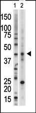 Anti-VRK1 Rabbit Polyclonal Antibody (FITC (Fluorescein))