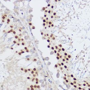 Immunohistochemistry analysis of paraffin-embedded rat testis using Anti-KLF12 Antibody (A306028) at a dilution of 1:100 (40x lens) Perform high pressure antigen retrieval with 10 mM citrate buffer pH 60 before commencing with IHC staining protocol