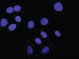 Anti-CCNB1 + CDKN1A Antibody Pair