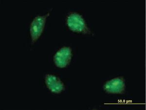 Anti-MAX Mouse Monoclonal Antibody [clone: 4E10-1A9]