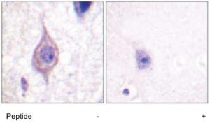 Anti-ALK Rabbit Polyclonal Antibody