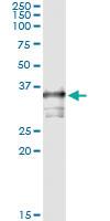 Anti-TOMM34 Antibody Pair