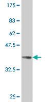 Anti-PAX8 Mouse Monoclonal Antibody [clone: 1D1]