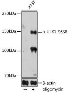 Western blot analysis of extracts of 293T cells, using Anti-ULK1 (phospho Ser638) Antibody (A308958) at 1:1,000 dilution