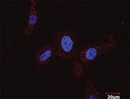 Anti-CCNB1 + CDKN1A Antibody Pair