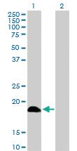 Anti-DCTD Rabbit Polyclonal Antibody