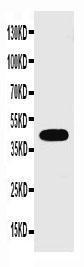 Anti-Connexin 43/GJA1 Rabbit Polyclonal Antibody