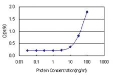 Anti-CBR1 Antibody Pair