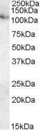 Antibody anti-ATP13A1 100 µg