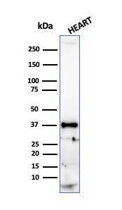 Western blot analysis of human heart tissue lysate using Anti-Histone H1 Antibody [r1415-1]