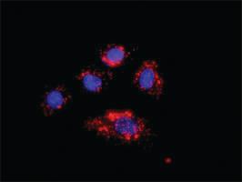 Anti-IKBKB + CTNNB1 Antibody Pair