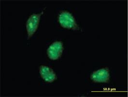 Anti-MAX Mouse Monoclonal Antibody [clone: 4E10-1A9]