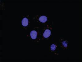 Anti-IKBKB + CTNNB1 Antibody Pair