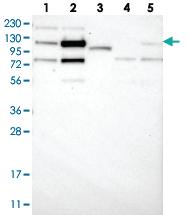 Anti-ZNF592 Rabbit Polyclonal Antibody