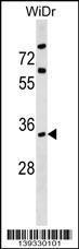 Anti-ARPC2 Rabbit Polyclonal Antibody (Biotin)