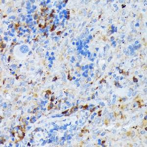 Anti-DC-SIGN Rabbit Monoclonal Antibody [clone: ARC1679]