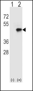 Anti-CD4 Rabbit Polyclonal Antibody (PE (Phycoerythrin))