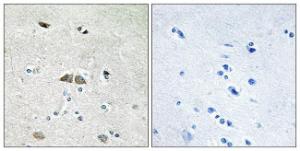 Immunohistochemical analysis of paraffin-embedded human brain using Anti-RPL39L Antibody. The right hand panel represents a negative control, where the antibody was pre-incubated with the immunising peptide