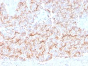 Immunohistochemical analysis of formalin-fixed, paraffin-embedded human lung using Anti-alpha Tubulin Antibody [TUBA/3038]