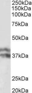 Anti-HP Antibody (A82845) (0.1µg/ml) staining of Human Liver lysate (35µg protein in RIPA buffer). Primary incubation was 1 hour. Detected by chemiluminescence.