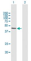 Anti-ALKBH1 Mouse Polyclonal Antibody