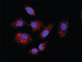 Anti-HNF4A + CTNNB1 Antibody Pair