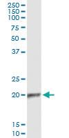 Anti-APOBEC3C Mouse Monoclonal Antibody [clone: 3E6]