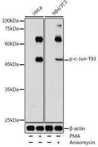 Western blot analysis of extracts of various cell lines, using Anti-c-Jun (phospho Thr93) Antibody (A308960) at 1:500 dilutio