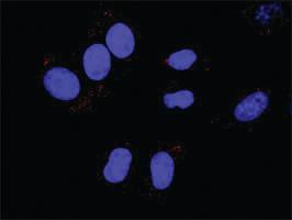 Anti-HNF4A + CTNNB1 Antibody Pair