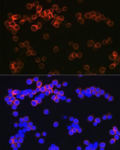 Anti-DC-SIGN Rabbit Monoclonal Antibody [clone: ARC1679]