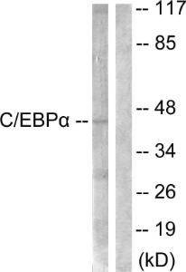 Western blot analysis of lysates from 293 cells, treated with Insulin 0.01U/ml 15' using Anti-CEBP alpha Antibody. The right hand lane represents a negative control, where the antibody is blocked by the immunising peptide