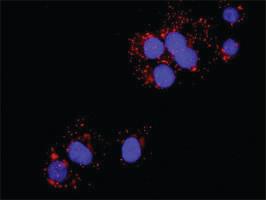 Anti-FYN + CTNNB1 Antibody Pair