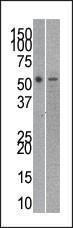 Anti-Reptin Rabbit Polyclonal Antibody (PE (Phycoerythrin))