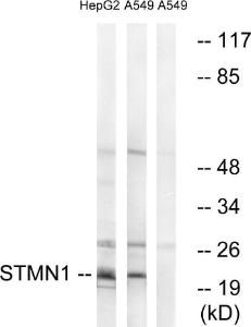 Anti-Stathmin 1 Rabbit Polyclonal Antibody