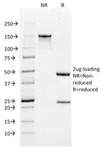 SDS-PAGE analysis of Anti-Histone H1 Antibody [rAE-4] under non-reduced and reduced conditions; showing intact IgG and intact heavy and light chains, respectively. SDS-PAGE analysis confirms the integrity and purity of the antibody