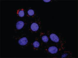 Anti-FYN + CTNNB1 Antibody Pair