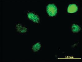 Anti-ALKBH1 Mouse Polyclonal Antibody