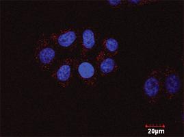 Anti-FYN + CTNNB1 Antibody Pair