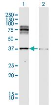 Anti-DCT Rabbit Polyclonal Antibody