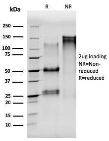 SDS-PAGE analysis of Anti-alpha Tubulin Antibody [TUBA/3038] under non-reduced and reduced conditions; showing intact IgG and intact heavy and light chains, respectively. SDS-PAGE analysis confirms the integrity and purity of the Antibody