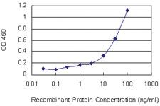 Anti-DCTN1 Mouse Monoclonal Antibody [clone: 1E12]