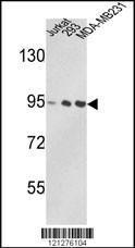 Anti-VCP Rabbit Polyclonal Antibody (AP (Alkaline Phosphatase))