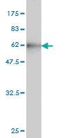 Anti-CBR1 Mouse Monoclonal Antibody [clone: 4D12-1G8]