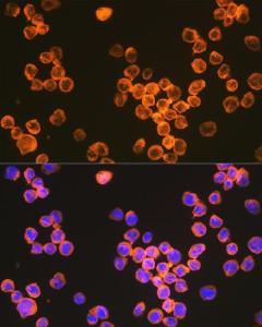 Anti-DC-SIGN Rabbit Monoclonal Antibody [clone: ARC1679]