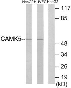 Western blot analysis of lysates from HepG2 and HUVEC cells using Anti-CAMK5 Antibody. The right hand lane represents a negative control, where the antibody is blocked by the immunising peptide.